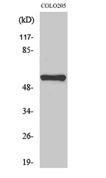 MITF rabbit pAb Antibody