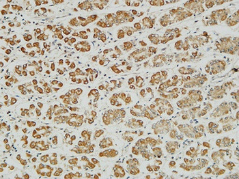 MITF rabbit pAb Antibody