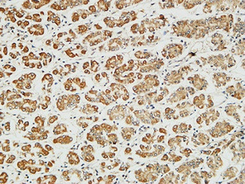 MITF rabbit pAb Antibody