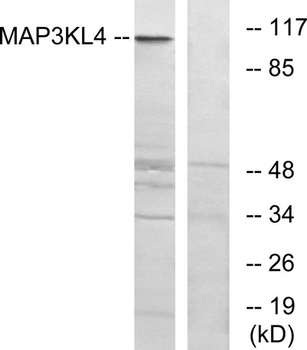 MLK4 rabbit pAb Antibody
