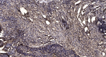 MLK4 rabbit pAb Antibody