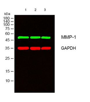 MMP-1 rabbit pAb Antibody