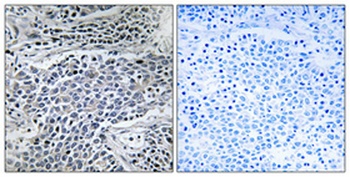 MMP-11 rabbit pAb Antibody