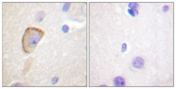 MOR-1 rabbit pAb Antibody