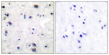 MOR-1 rabbit pAb Antibody