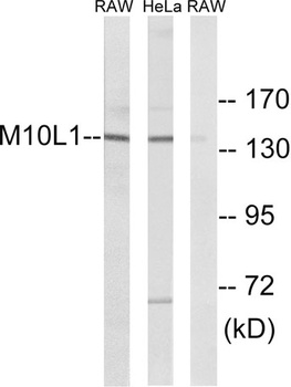 MOV10L1 rabbit pAb Antibody