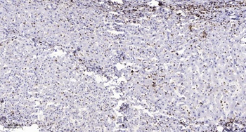 MPP9 rabbit pAb Antibody