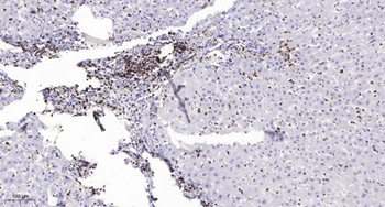 MRCKα rabbit pAb Antibody