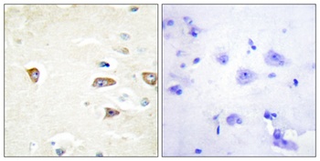 MRCKβ rabbit pAb Antibody