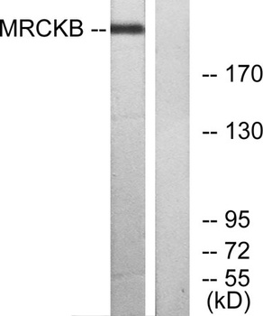 MRCKβ rabbit pAb Antibody