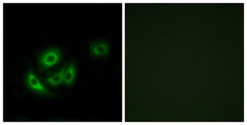 MRP-L11 rabbit pAb Antibody