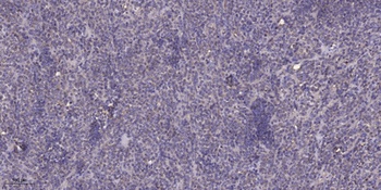 MRP-L18 rabbit pAb Antibody