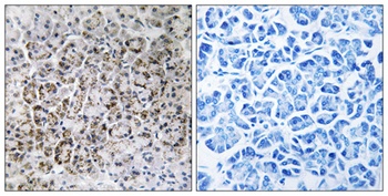 MRP-L40 rabbit pAb Antibody