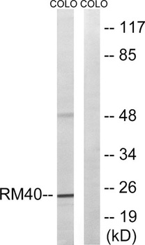 MRP-L40 rabbit pAb Antibody