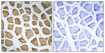 MRP-S22 rabbit pAb Antibody