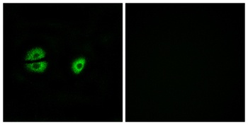 MRP-S22 rabbit pAb Antibody