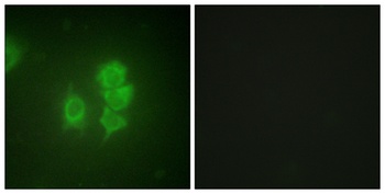MSK1 rabbit pAb Antibody