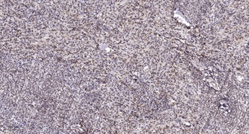 MSK1 rabbit pAb Antibody