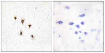 MVK rabbit pAb Antibody