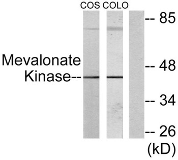 MVK rabbit pAb Antibody