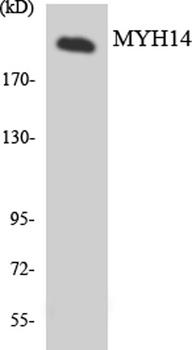 MYH14 rabbit pAb Antibody
