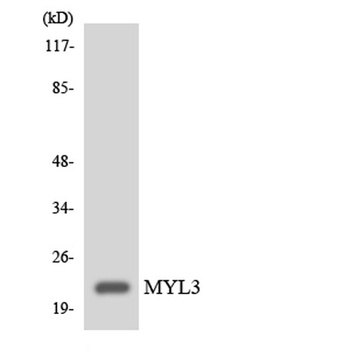 MYL3 rabbit pAb Antibody