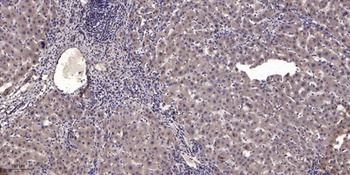 Myomesin-2 rabbit pAb Antibody