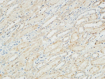 Na+/K+-ATPase α1 rabbit pAb Antibody