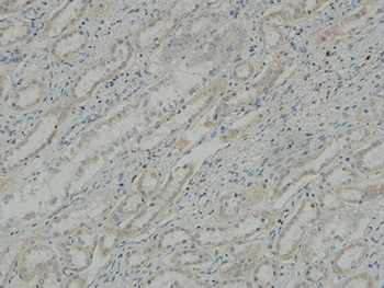 Na+/K+-ATPase α1 rabbit pAb Antibody