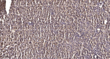 NARG1 rabbit pAb Antibody