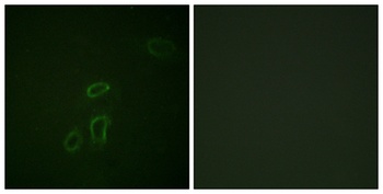 NCAM-L1 rabbit pAb Antibody