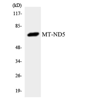 ND5 rabbit pAb Antibody