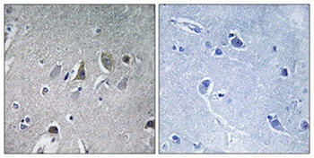 NDUFV2 rabbit pAb Antibody