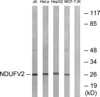 NDUFV2 rabbit pAb Antibody