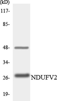 NDUFV2 rabbit pAb Antibody