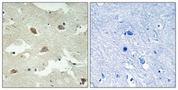 NEEP21 rabbit pAb Antibody