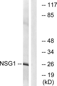 NEEP21 rabbit pAb Antibody
