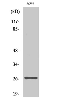 NET-5 rabbit pAb Antibody