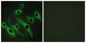 Neu rabbit pAb Antibody
