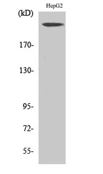 Neurofibromin rabbit pAb Antibody