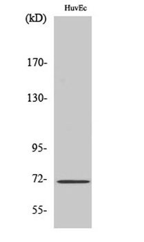 NF2 rabbit pAb Antibody