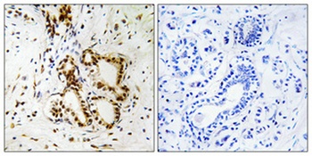 NF2 rabbit pAb Antibody