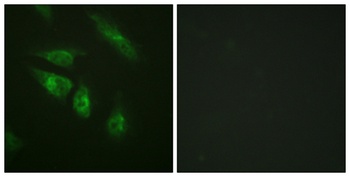 NFATc4 rabbit pAb Antibody
