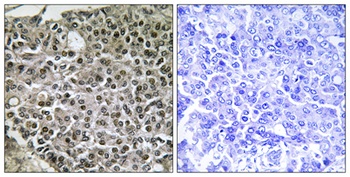 NFATc4 rabbit pAb Antibody