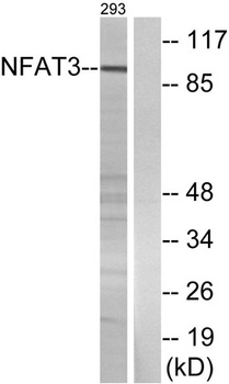 NFATc4 rabbit pAb Antibody