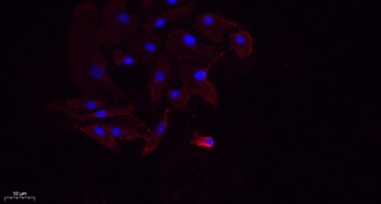 NGF rabbit pAb Antibody