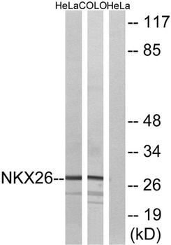 Nkx-2.6 rabbit pAb Antibody
