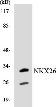 Nkx-2.6 rabbit pAb Antibody