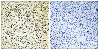 NPM rabbit pAb Antibody