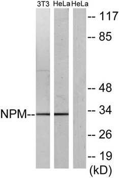NPM rabbit pAb Antibody